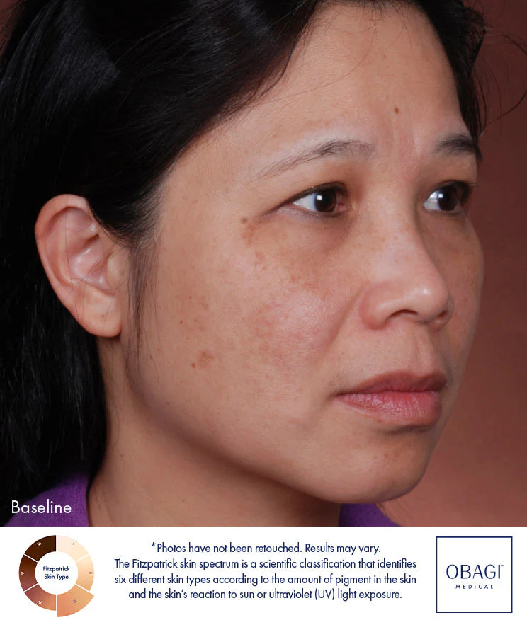 Obagi Nu-Derm Blend Fx