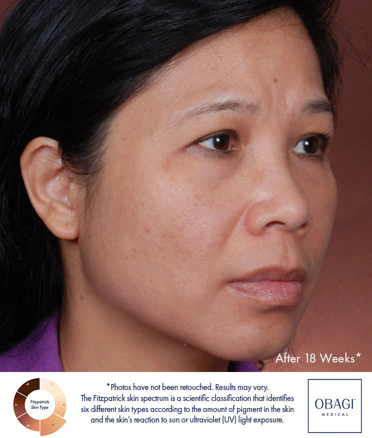 Obagi Nu-Derm Blend Fx